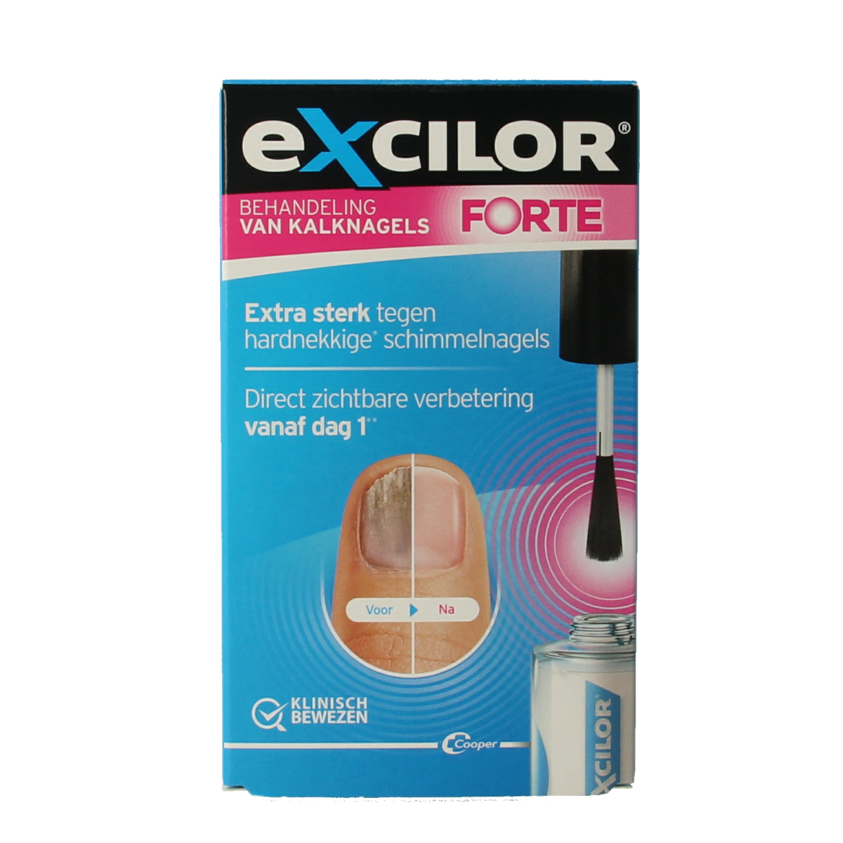 Excilor Kalknagel forte 1.00 Stuks