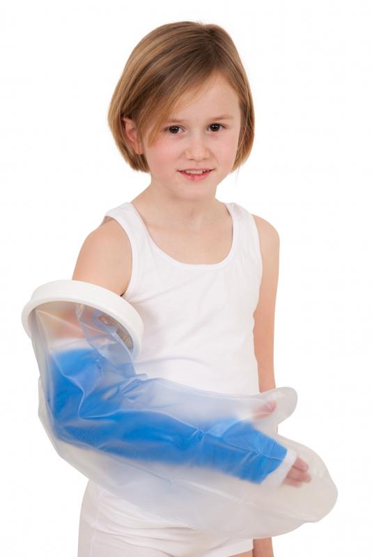 Able 2 Gipshoes hele arm kind 1.00 Stuks